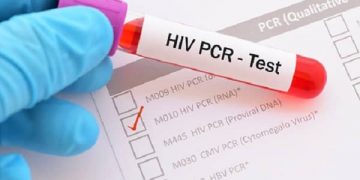 Pruebas PCR para VIH, salud