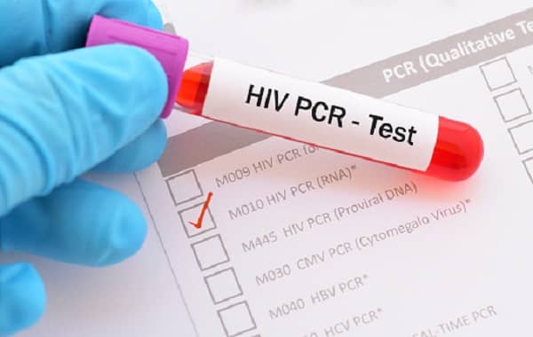 Pruebas PCR para VIH, salud