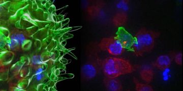 Сélulas T atacando células cancerosas