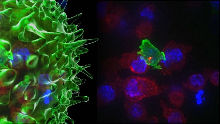 Сélulas T atacando células cancerosas